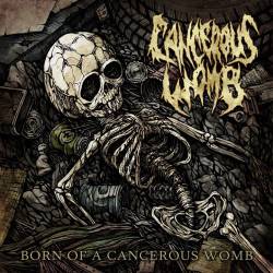 Cancerous Womb : Born of a Cancerous Womb
